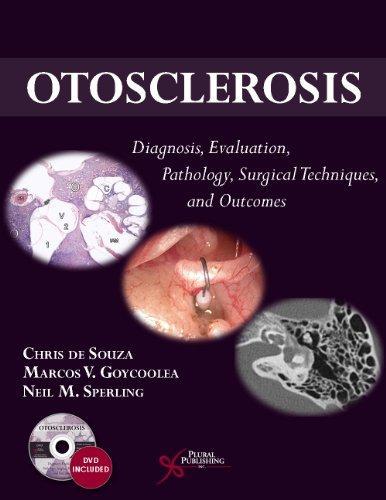 Otosclerosis Diagnosis Evaluation Pathology Surgical Techniques And Outcomes (PDF Instant Download)