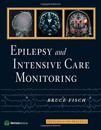 Epilepsy and Intensive Care Monitoring: Principles and Practice (PDF Instant Download)