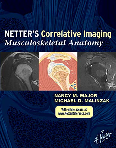 Netter’s Correlative Imaging: Musculoskeletal Anatomy: with Online Access at www.NetterReference.com, 1e (PDF Instant Download)