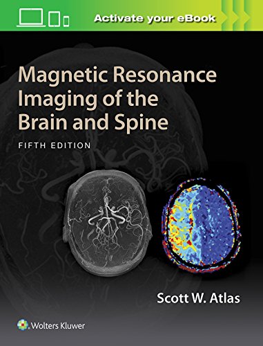 Magnetic Resonance Imaging of the Brain and Spine (PDF Instant Download)