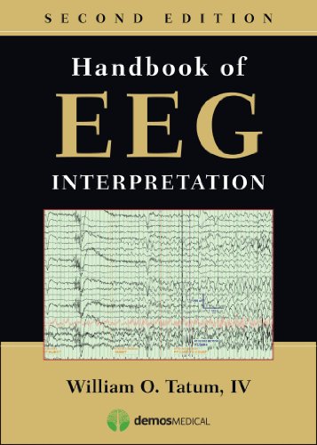 Handbook of EEG Interpretation – 2nd Edition (PDF Instant Download)
