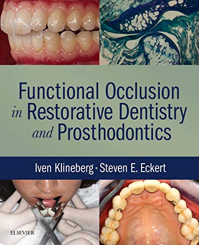 Functional Occlusion in Restorative Dentistry and Prosthodontics, 1e (PDF Instant Download)
