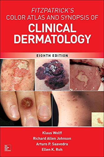Fitzpatrick’s Color Atlas and Synopsis of Clinical Dermatology – 8th Edition (PDF Instant Download)