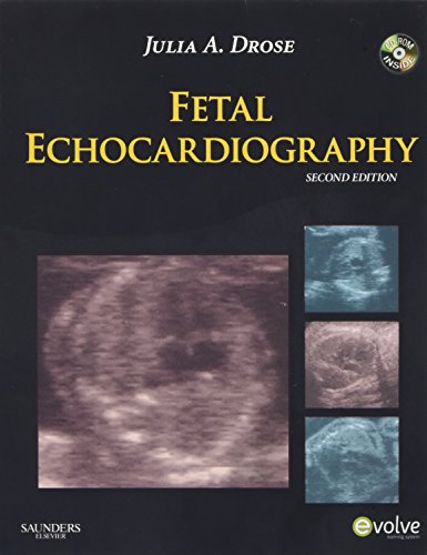 Fetal Echocardiography (PDF Instant Download)