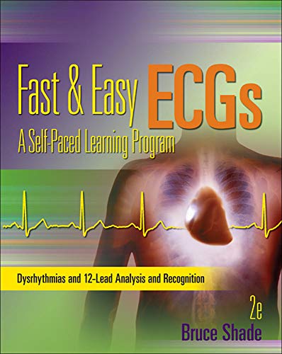 Fast & easy ECGs : a self-paced learning program – 2nd Edition (PDF Instant Download)