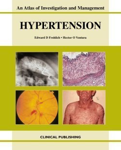 Hypertension: An Atlas of Investigation and Management   1 Edition (PDF Instant Download)