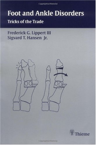 Foot and ankle disorders: tricks of the trade  Edition (PDF Instant Download)