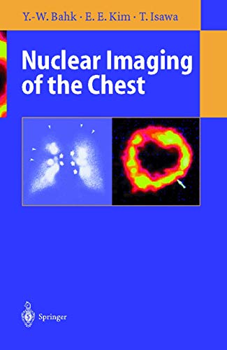Nuclear Imaging of the Chest 1 Edition (PDF Instant Download)