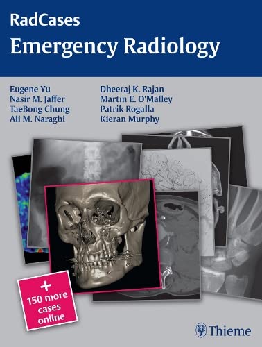 Emergency radiology  Edition (PDF Instant Download)