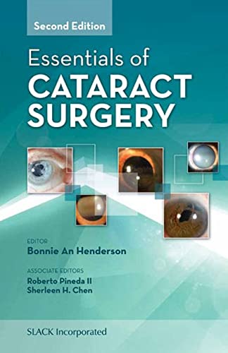 Essentials of Cataract Surgery Second Edition Edition (PDF Instant Download)
