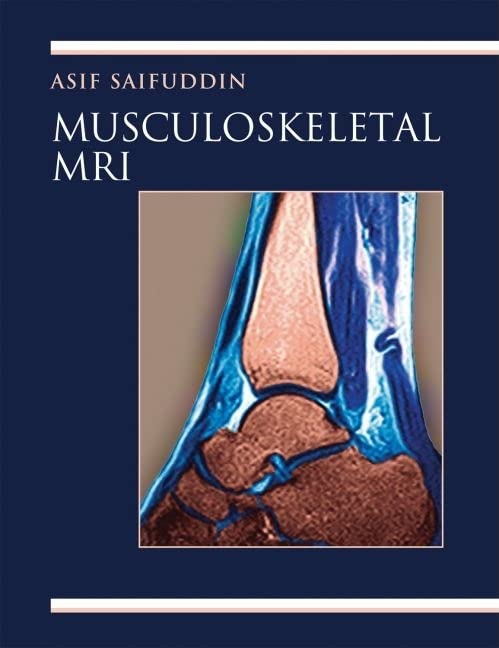 Musculoskeletal MRI 1 Edition (PDF Instant Download)