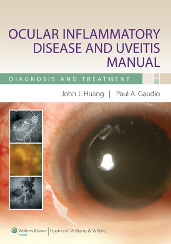 Ocular Inflammatory Disease and Uveitis Manual: Diagnosis and Treatment 1 Edition (PDF Instant Download)