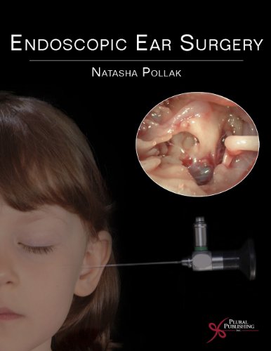Endoscopic Ear Surgery 1 Edition (PDF Instant Download)