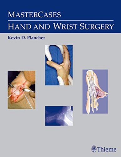 MasterCases Hand and Wrist Surgery 1 Edition (PDF Instant Download)