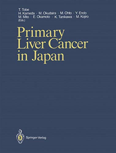 Primary Liver Cancer in Japan 1 Edition (PDF Instant Download)