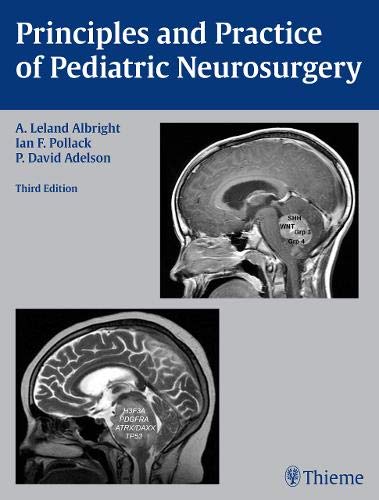 Principles and Practice of Pediatric Neurosurgery 3rd edition Edition (PDF Instant Download)