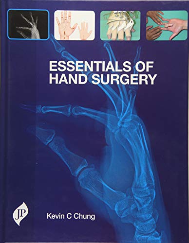 Essentials of hand surgery  Edition (PDF Instant Download)
