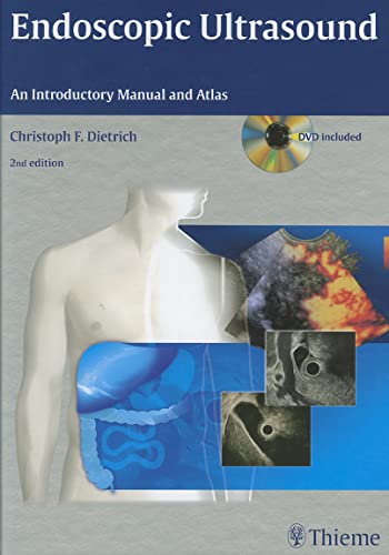 Endoscopic ultrasound: an introductory manual and atlas 2nd edition Edition (PDF Instant Download)
