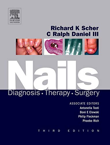 Nails: Diagnosis, Therapy, Surgery, Third Edition 3 Edition (PDF Instant Download)