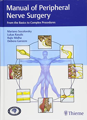 Manual of peripheral nerve surgery from the basics to complex procedures  Edition (PDF Instant Download)