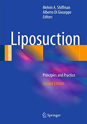 Liposuction: Principles and Practice  Edition (PDF Instant Download)