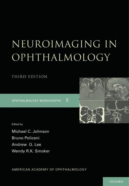 Neuroimaging in Ophthalmology (Opthamology Monograph Series) 2 Edition (PDF Instant Download)