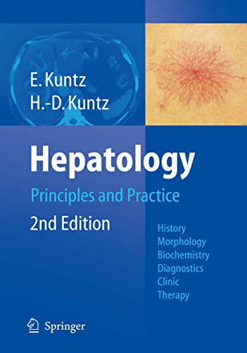 Hepatology: principles and practice: history, morphology, biochemistry, diagnostics, clinic, therapy 2nd Edition (PDF Instant Download)