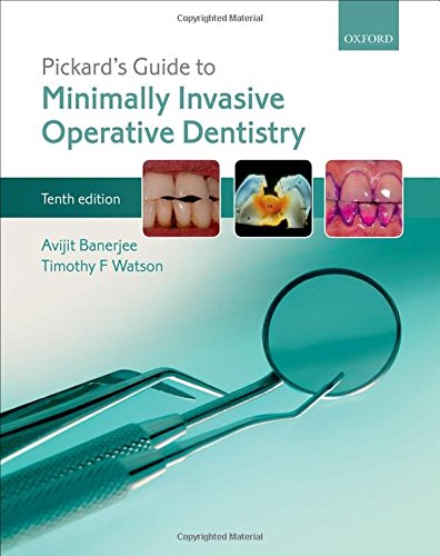 Pickard?s Guide to Minimally Invasive Operative Dentistry (10th Edition) (PDF Instant Download)