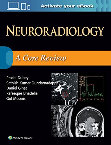 Neuroradiology: A Core Review (PDF Instant Download)
