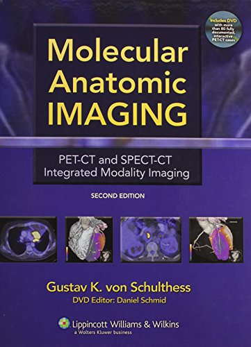 Molecular Anatomic Imaging: PET-CT and SPECT-CT Integrated Modality Imaging (2nd Edition) (PDF Instant Download)