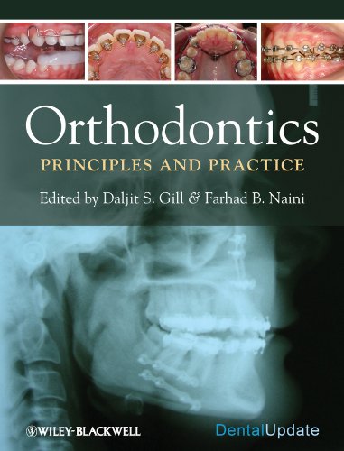 Orthodontics: Principles and Practice (Dental Update) 1 Edition (PDF Instant Download)