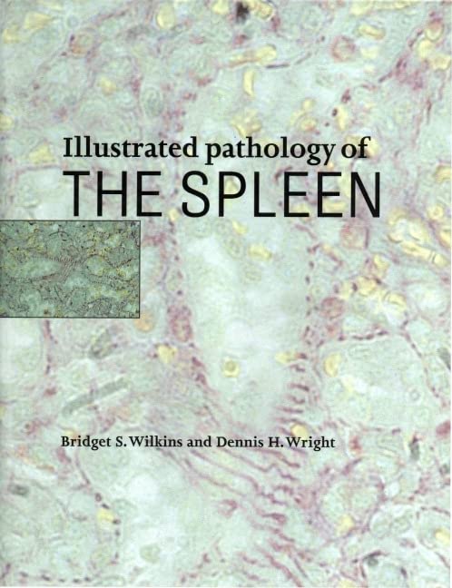 Illustrated Pathology of the Spleen   1 Edition (PDF Instant Download)