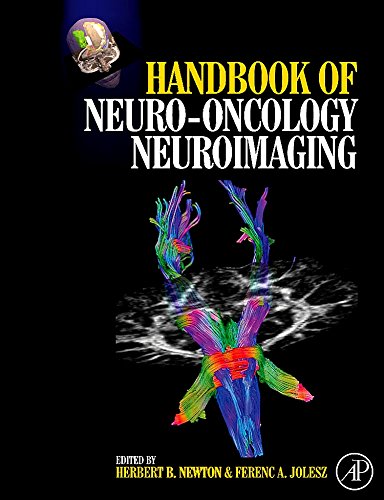 Handbook of Neuro-Oncology Neuro-Imaging 1 Edition (PDF Instant Download)
