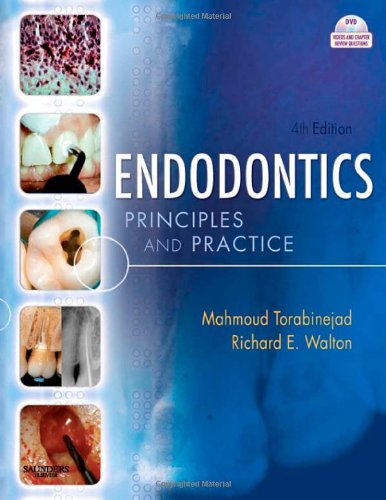 Endodontics: Principles and Practice, 4e 4 Edition (PDF Instant Download)