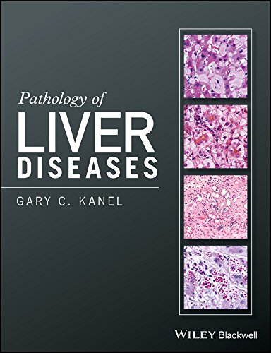 Pathology of liver diseases  Edition (PDF Instant Download)