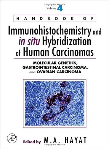 Molecular Genetics, Gastrointestinal Carcinoma, and Ovarian Carcinoma 1 Edition (PDF Instant Download)
