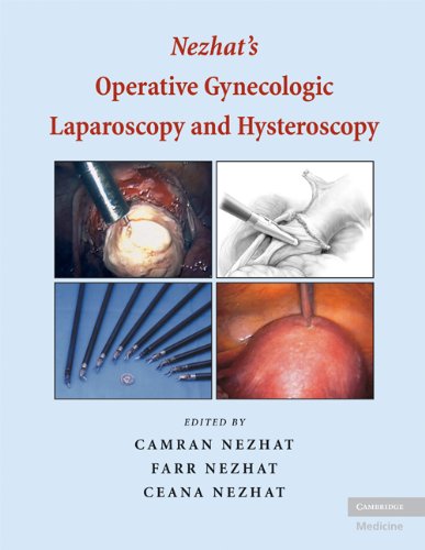 Nezhat's Operative Gynecologic Laparoscopy and Hysteroscopy 3 Edition (PDF Instant Download)
