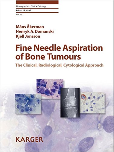 Fine Needle Aspiration of Bone Tumours: The Clinical, Radiological, Cytological Approach (Monographs in Clinical Cytology Vol 19) 1 Edition (PDF Instant Download)