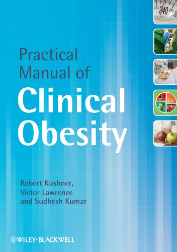 Practical Manual of Clinical Obesity 1 Edition (PDF Instant Download)