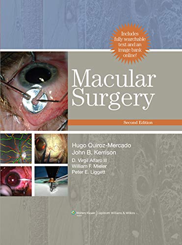 Macular Surgery 2 Edition (PDF Instant Download)
