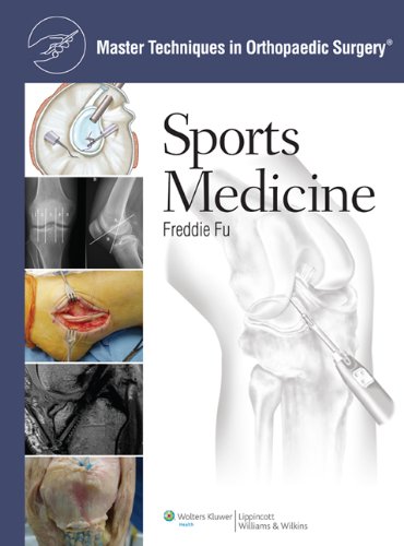 Master Techniques in Orthopaedic Surgery: Sports Medicine 1 Har/Psc Edition (PDF Instant Download)