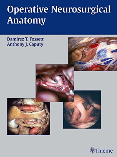 Operative Neurosurgical Anatomy  Edition (PDF Instant Download)