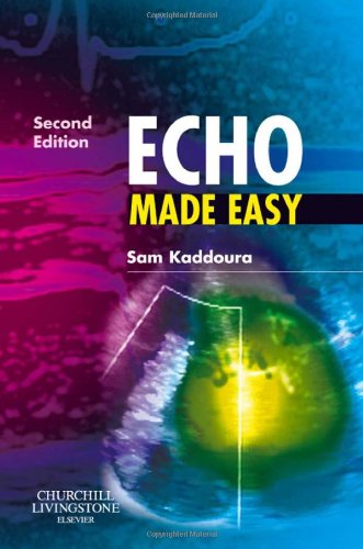 Echo Made Easy 2nd Edition (PDF Instant Download)