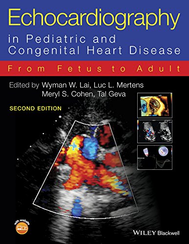 Echocardiography in Pediatric and Congenital Heart Disease: From Fetus to Adult 2 Edition (PDF Instant Download)