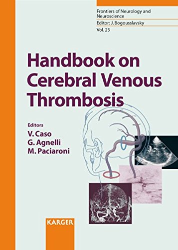 Handbook on Cerebral Venous Thrombosis (Frontiers of Neurology and Neuroscience) 1 Edition (PDF Instant Download)