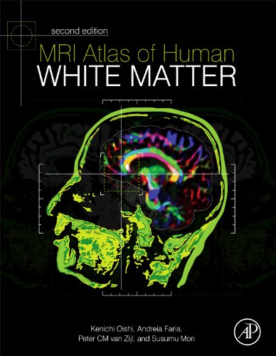 MRI Atlas of Human White Matter 2 Edition (PDF Instant Download)