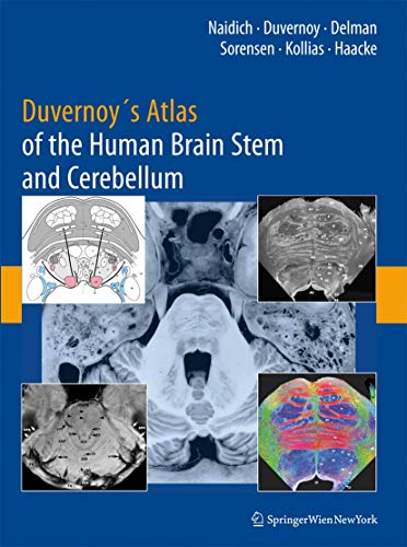 Duvernoy's Atlas Of The Human Brain Stem And Cerebellum 1st Edition (PDF Instant Download)