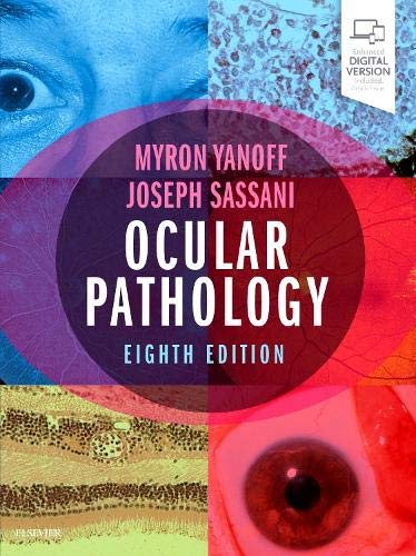 Ocular Pathology 8 Edition (PDF Instant Download)