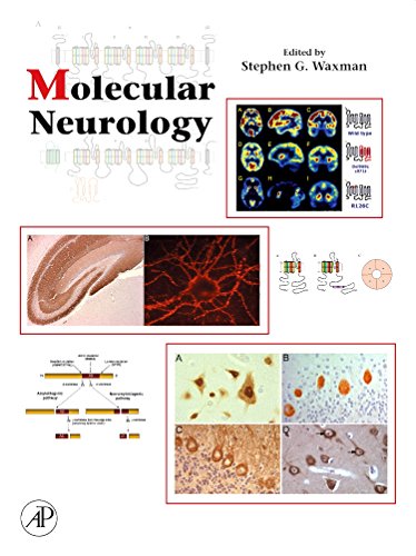 Molecular neurology  Edition (PDF Instant Download)
