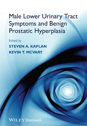 Male Lower Urinary Tract Symptoms and Benign Prostatic Hyperplasia 1 Edition (PDF Instant Download)